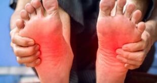 أمل جاسم: ٪80 من حالات بتر قدم السكري يمكن تجنبها بالعناية اليومية