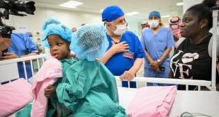 السعودية.. نجاح فصل التوأم السيامي الجامايكي «أزاريا وأزورا» في الرياض