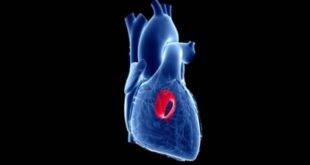 برنامج روسي مبتكر لإعادة بناء صمام تاجي مخصص لكل مريض