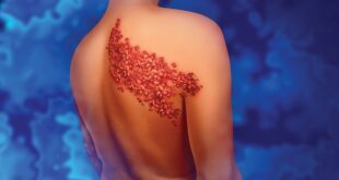 جمعة: لقاح الحزام الناري حماية للفرد والمجتمع ومتوفر بالمراكز الصحية