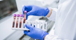 علماء: مؤشرات دقيقة في الدم ترتبط بطول العمر